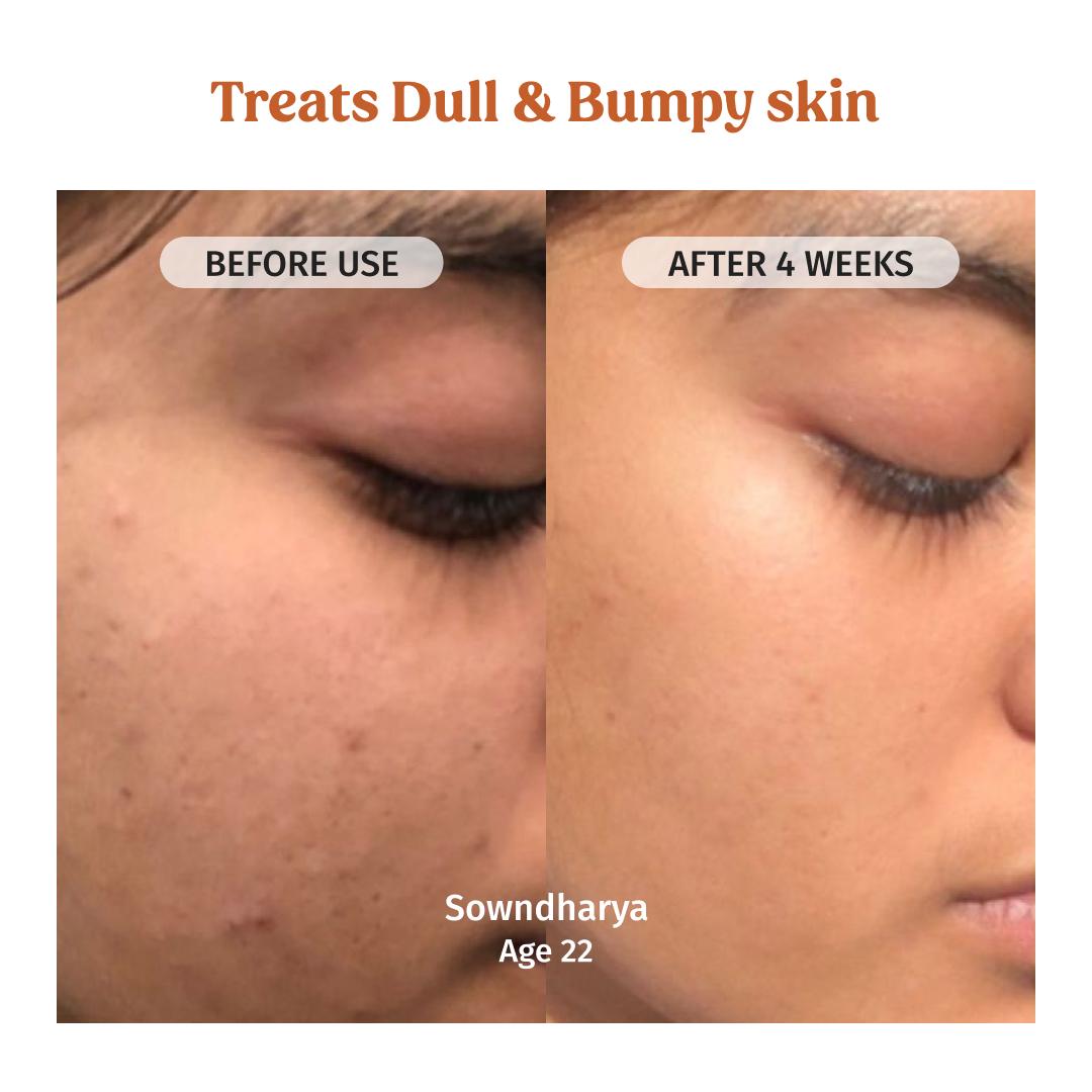 Milk Powder Facewash