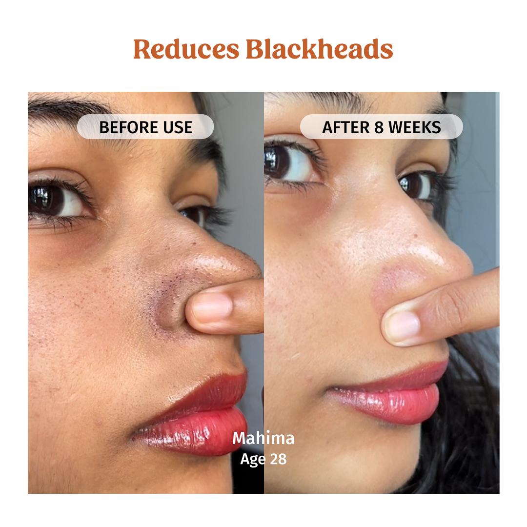 Milk Powder Facewash